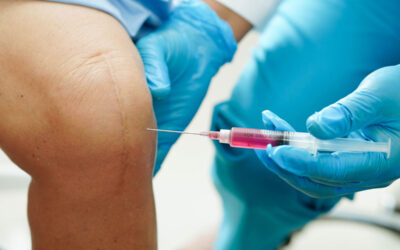 PRP Treatment: What Is Platelet-Rich Plasma Therapy?
